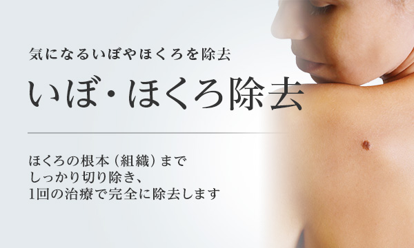 東京美容外科 ほくろ除去
