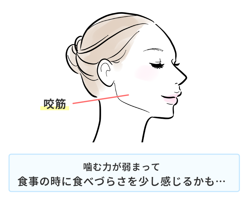 エラボトックス 後悔