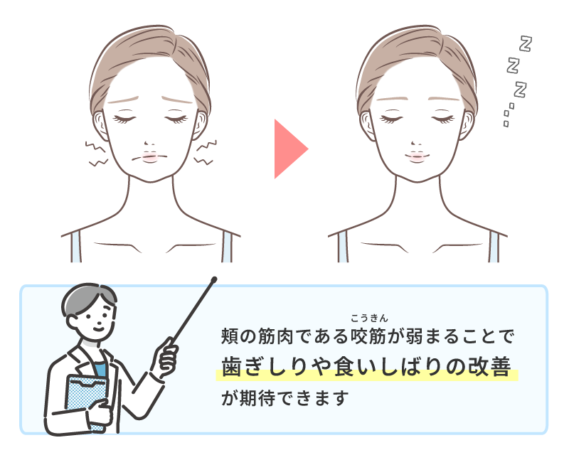 エラボトックス 後悔