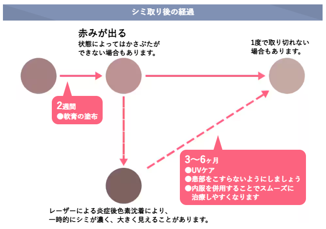湘南美容クリニック シミ取り
