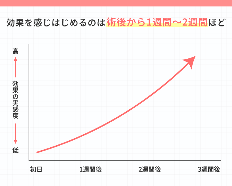 エラボトックス 後悔