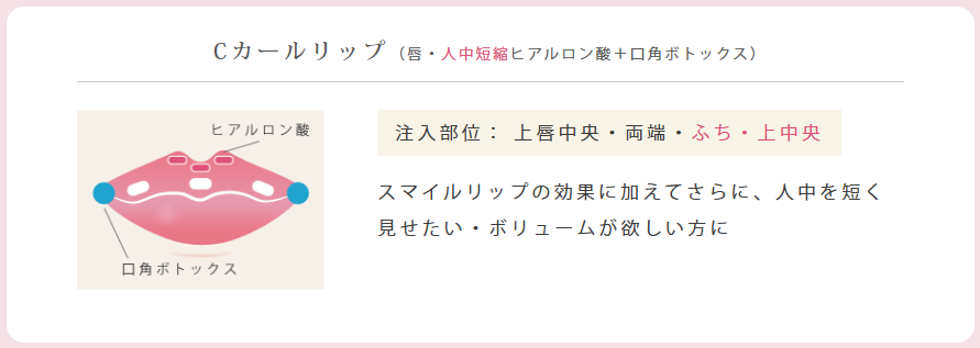 ルラ美容クリニック Cカールリップ
