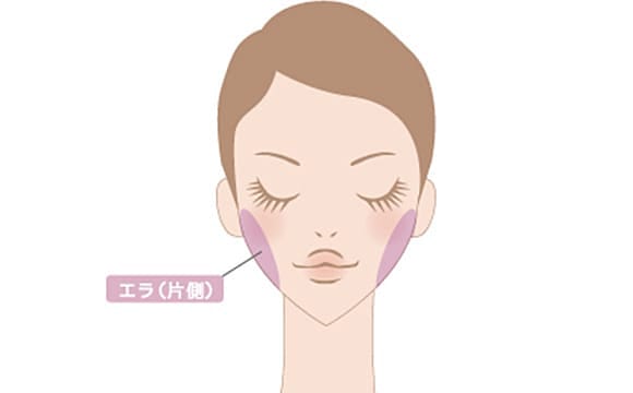 エラボトックス 品川美容外科