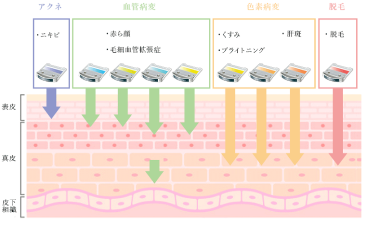 聖心美容クリニック セレックV