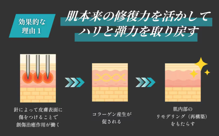 湘南　モフィウス