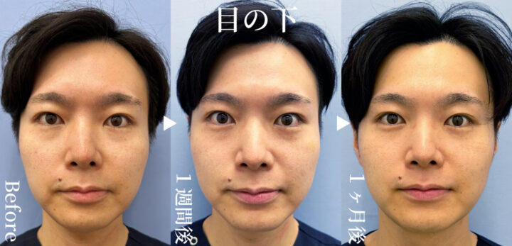 湘南 モフィウス