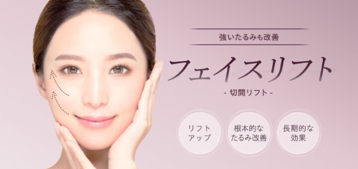 湘南美容クリニック フェイスリフト