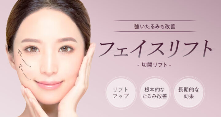 湘南 フェイスリフト