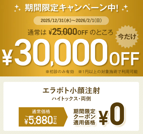 TCBエラボト
