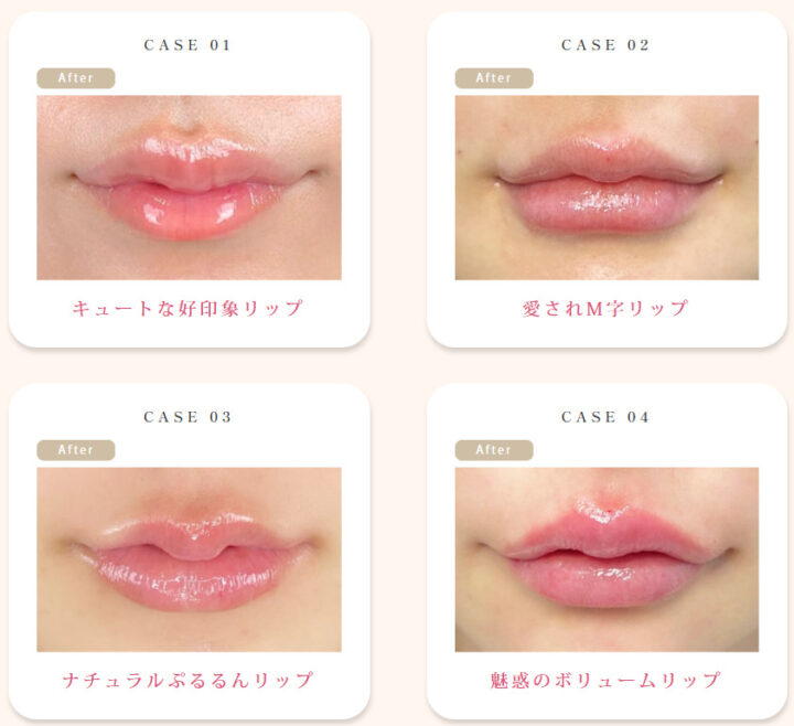 ルラ Cカールリップ