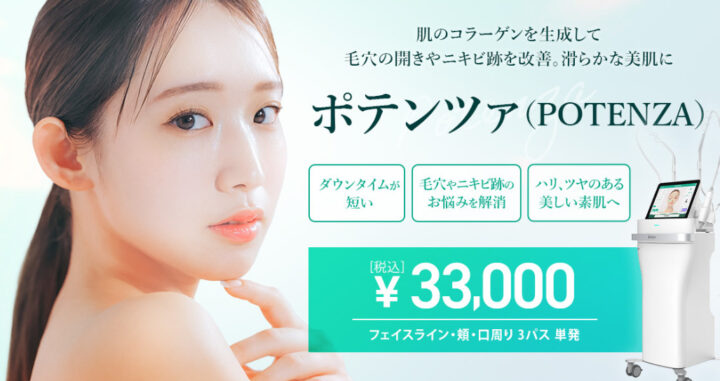 TCB ポテンツァ