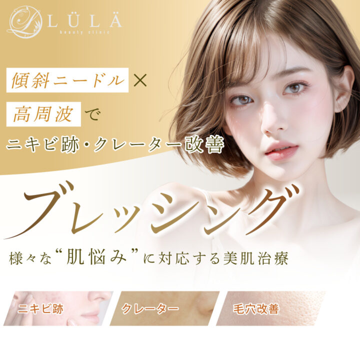 ルラ ブレッシング