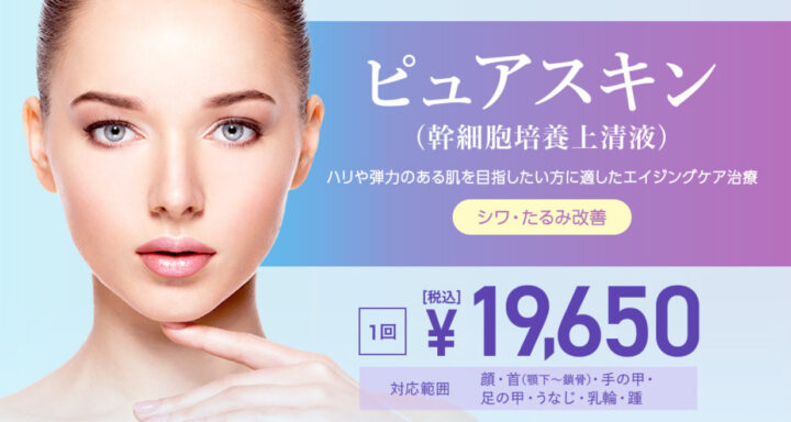 TCB　イオン導入