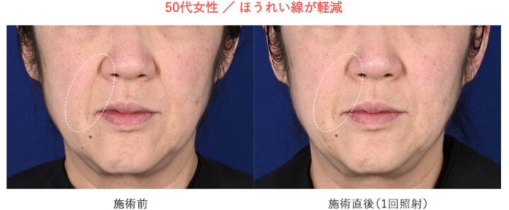 湘南美容クリニック ザーフ 症例画像