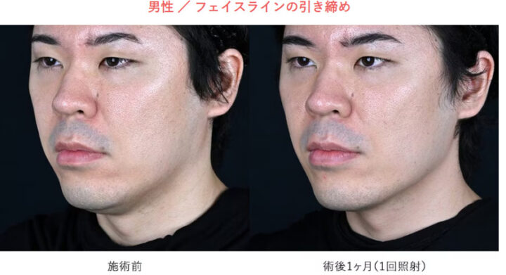 湘南美容クリニック ザーフ 症例画像