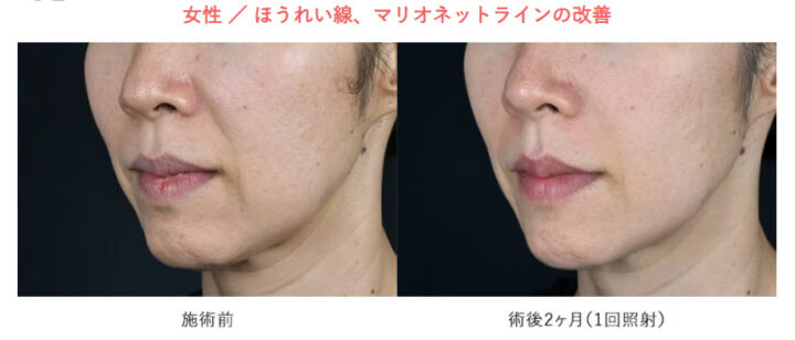湘南美容クリニック ザーフ 症例画像