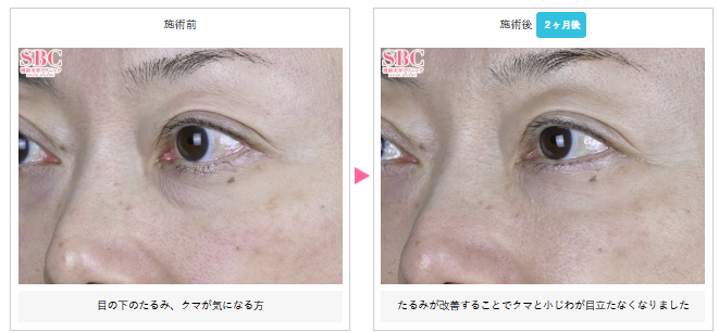 湘南美容クリニック モフィウス8