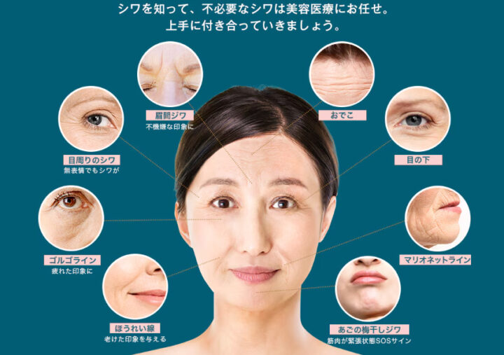 湘南 シワ取りヒアル