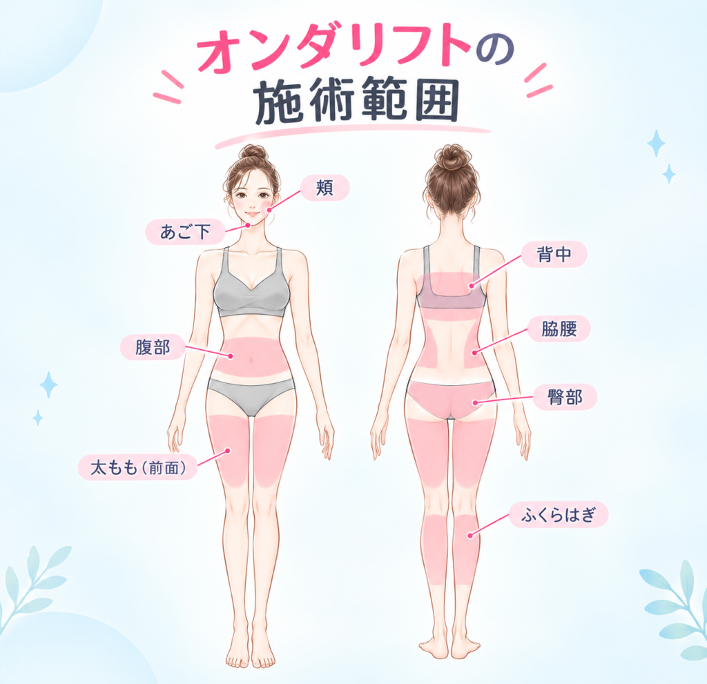 オンダリフト施術範囲